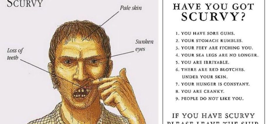 Scurvy &#8211; a disease of sailors. The causes and treatment of scurvy