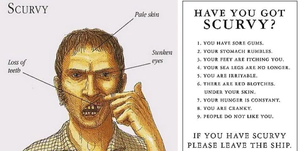 Scurvy &#8211; a disease of sailors. The causes and treatment of scurvy