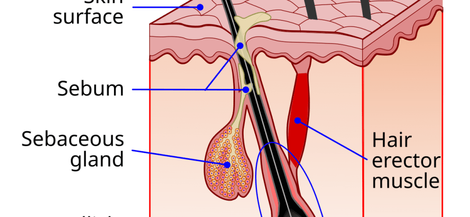 Sebum &#8211; what is it? What is excess sebum characterized by? [WE EXPLAIN]