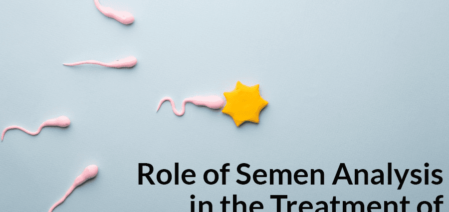 Semen analysis in the treatment of infertility. When to do a semen analysis?