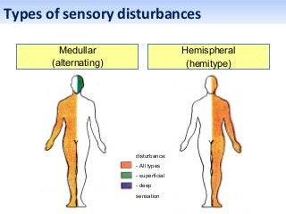 Sensory disturbance