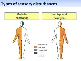 Sensory disturbance