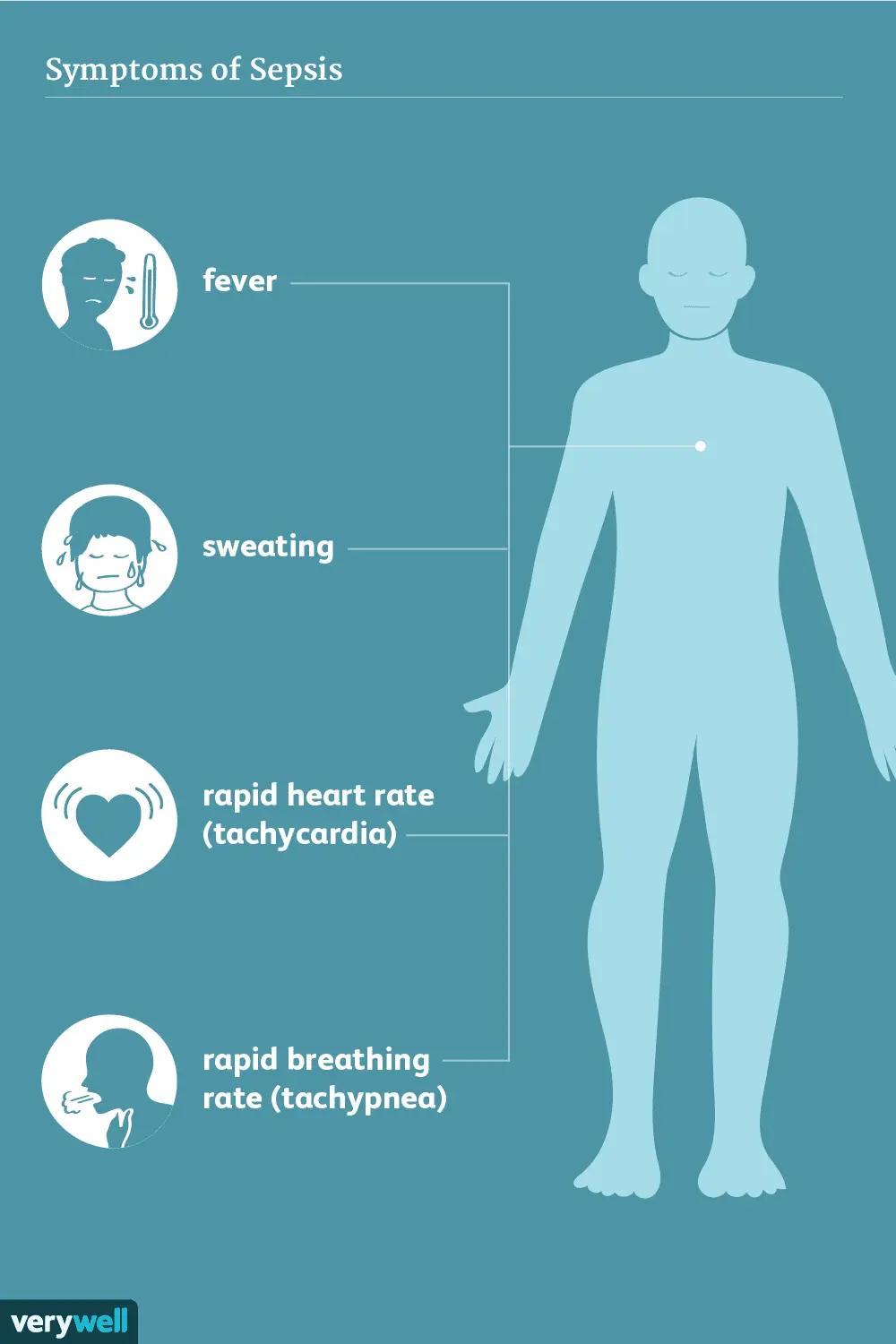 Sepsis &#8211; symptoms, treatment