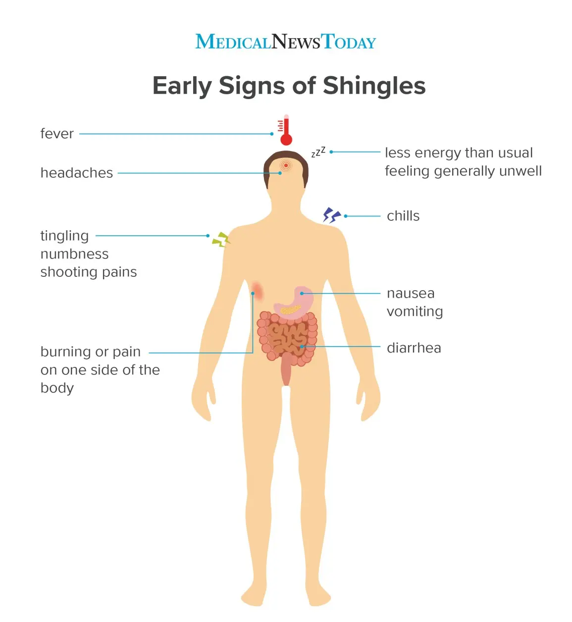 Shingles &#8211; Will I Get Additional Symptoms?