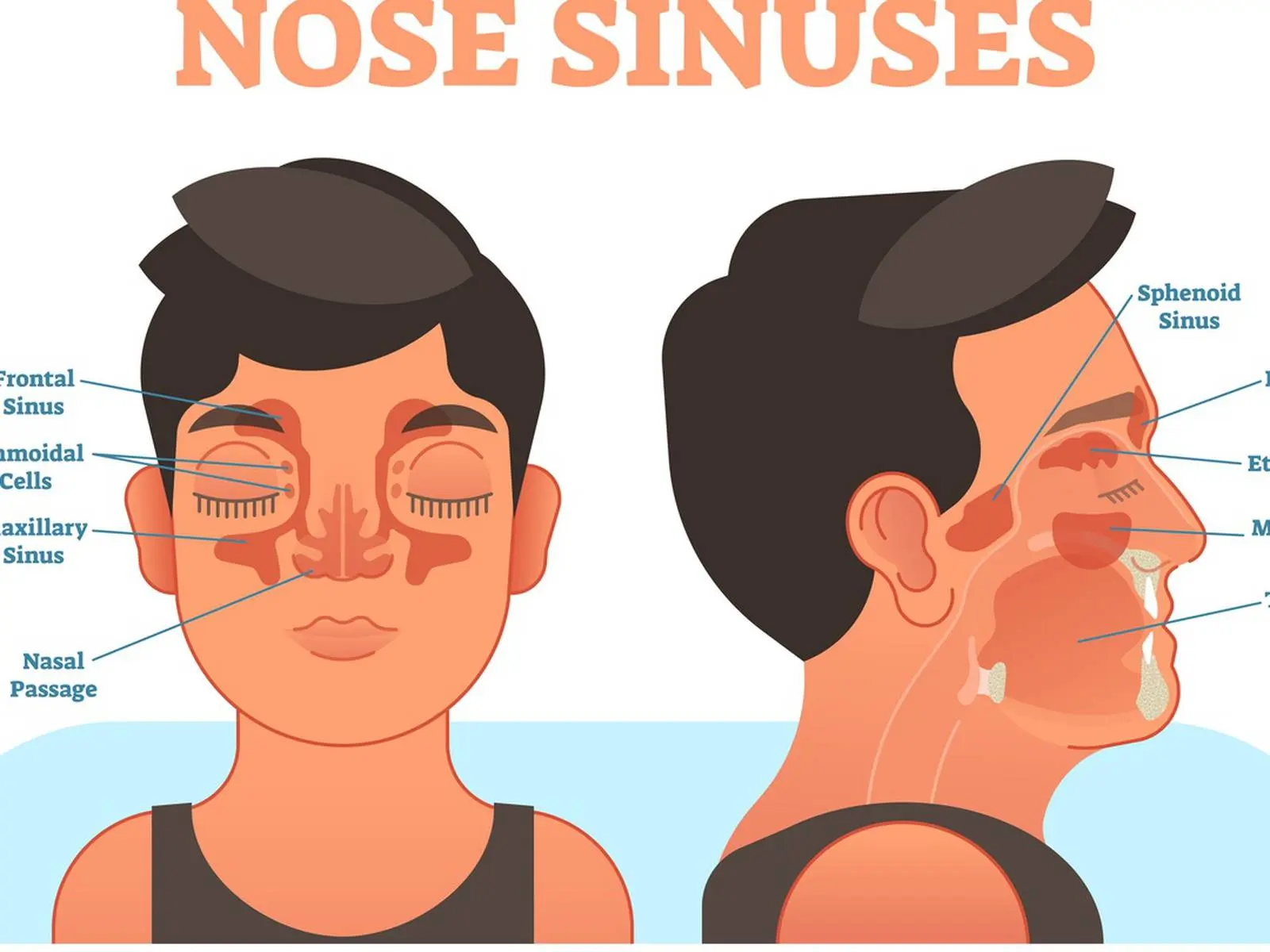 Sinus irrigation &#8211; when is it worth doing? Complications after rinsing the sinuses