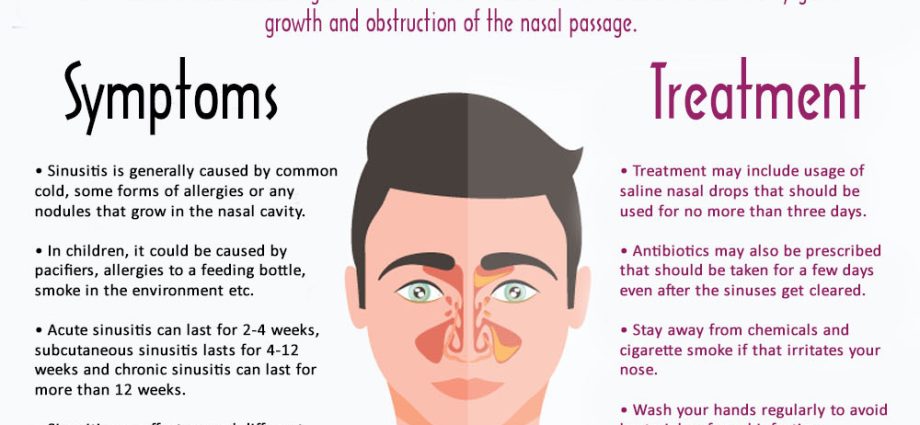 Sinusitis &#8211; Causes, Symptoms, Treatment. Complications of sinusitis