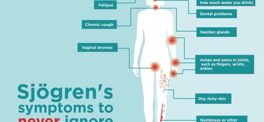 Sjögren&#8217;s syndrome &#8211; causes, symptoms, treatment. Living with Sjögren&#8217;s syndrome