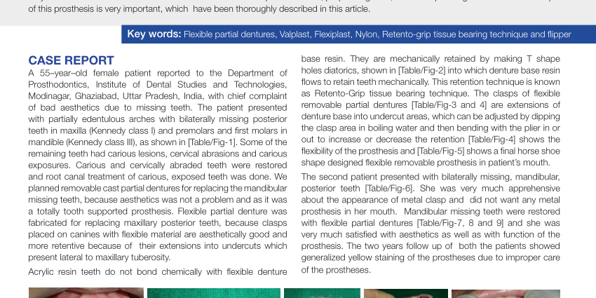 Skeletal dentures &#8211; indications for wearing. Advantages and disadvantages of frame dentures