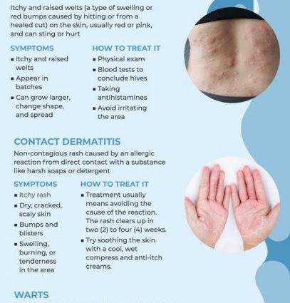 Skin diseases &#8211; symptoms, treatment. What do skin changes mean?