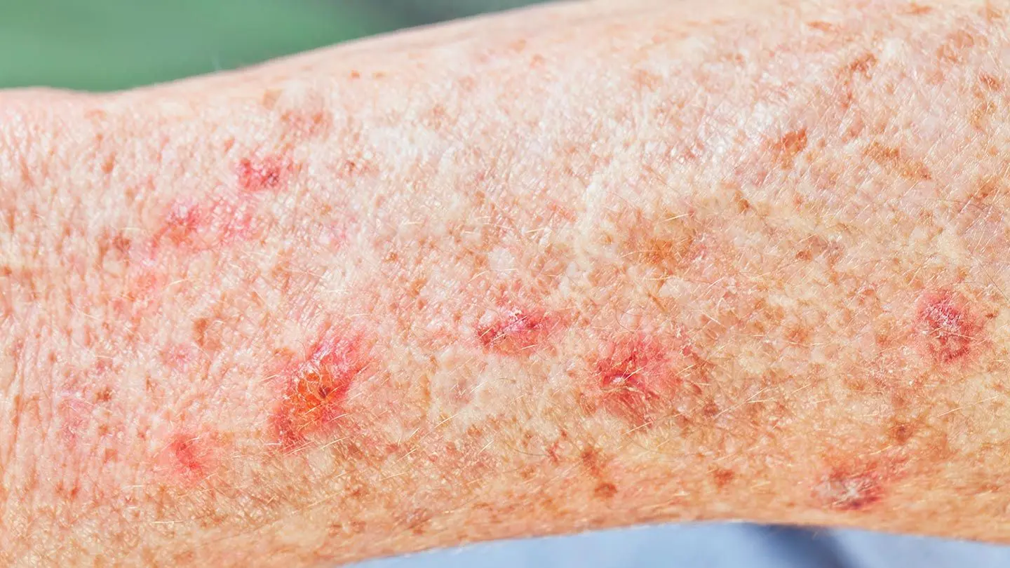 Skin diseases. What do you need to know about them?