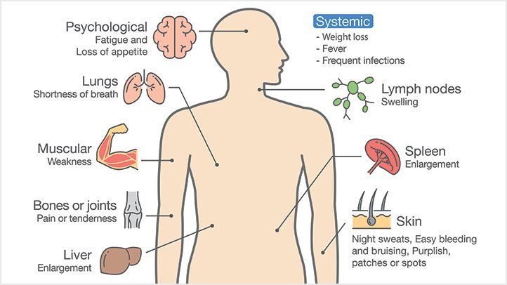 Skin leukemia &#8211; common symptoms