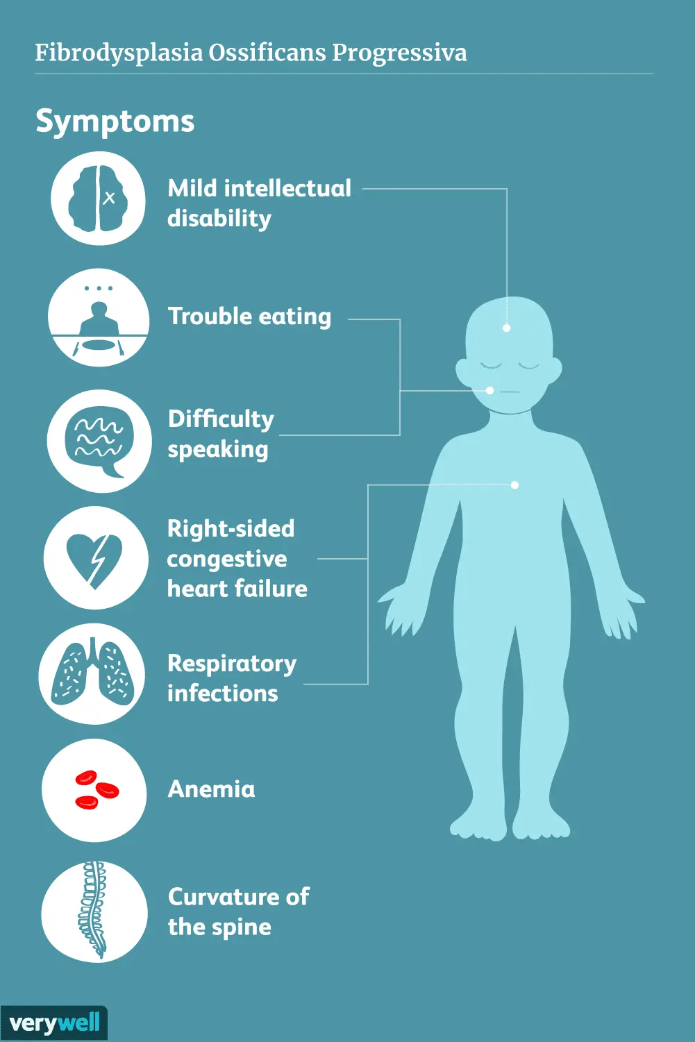 Skin ossification &#8211; symptoms, treatment, prognosis