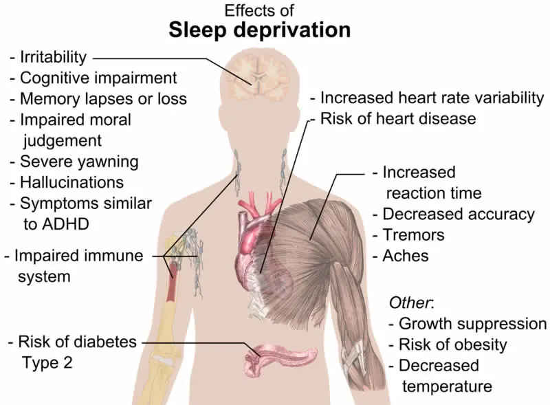 Sleep deprivation can cause symptoms similar to schizophrenia