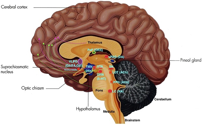 Sleep problems are linked to defects in the brain