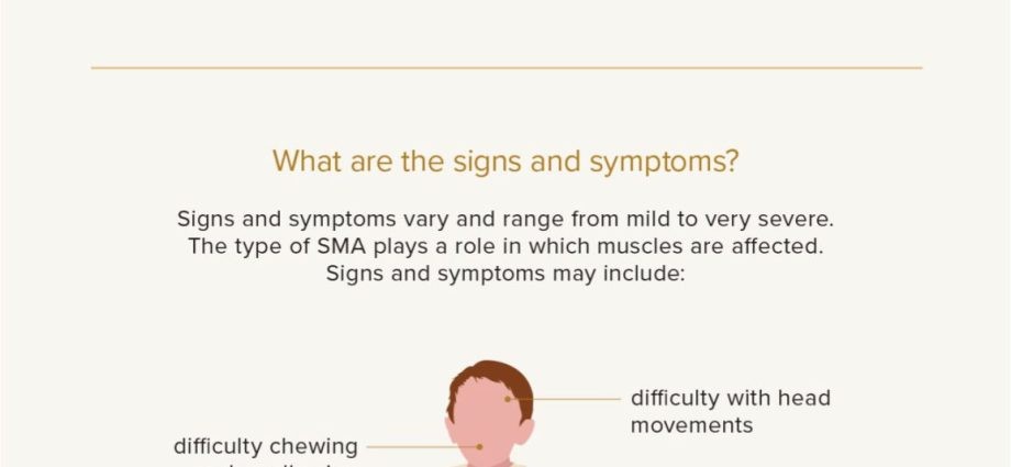 SMA &#8211; causes and symptoms. What is the treatment for spinal muscular atrophy?