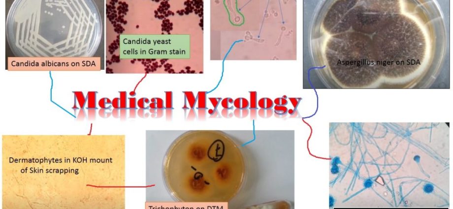 Small spore mycosis &#8211; appearance, diagnosis, treatment