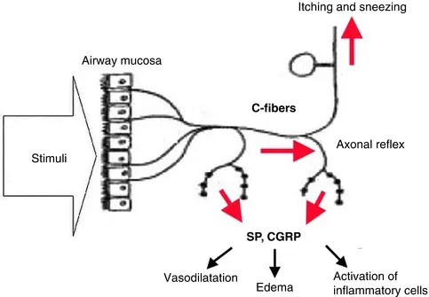 Sneezing &#8211; What Does It Mean? What is the mechanism of sneezing?