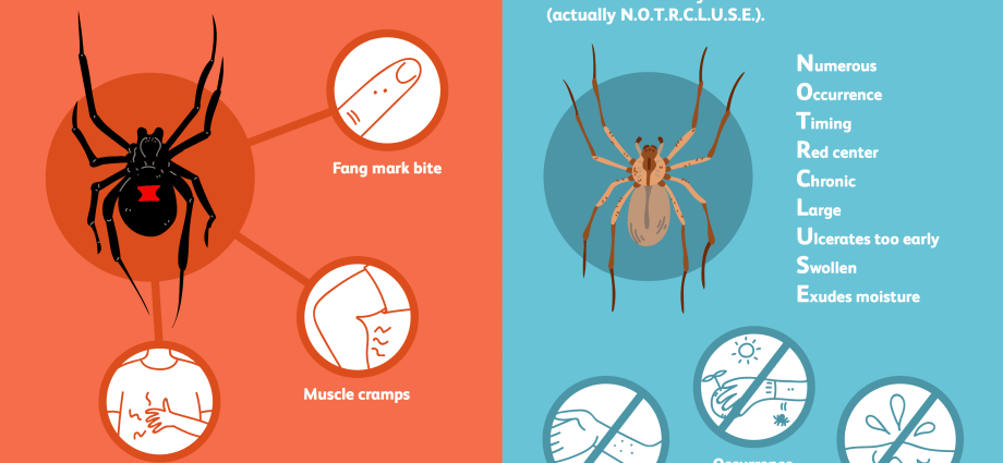 クモの咬傷 – 特徴的な症状、クモの種類