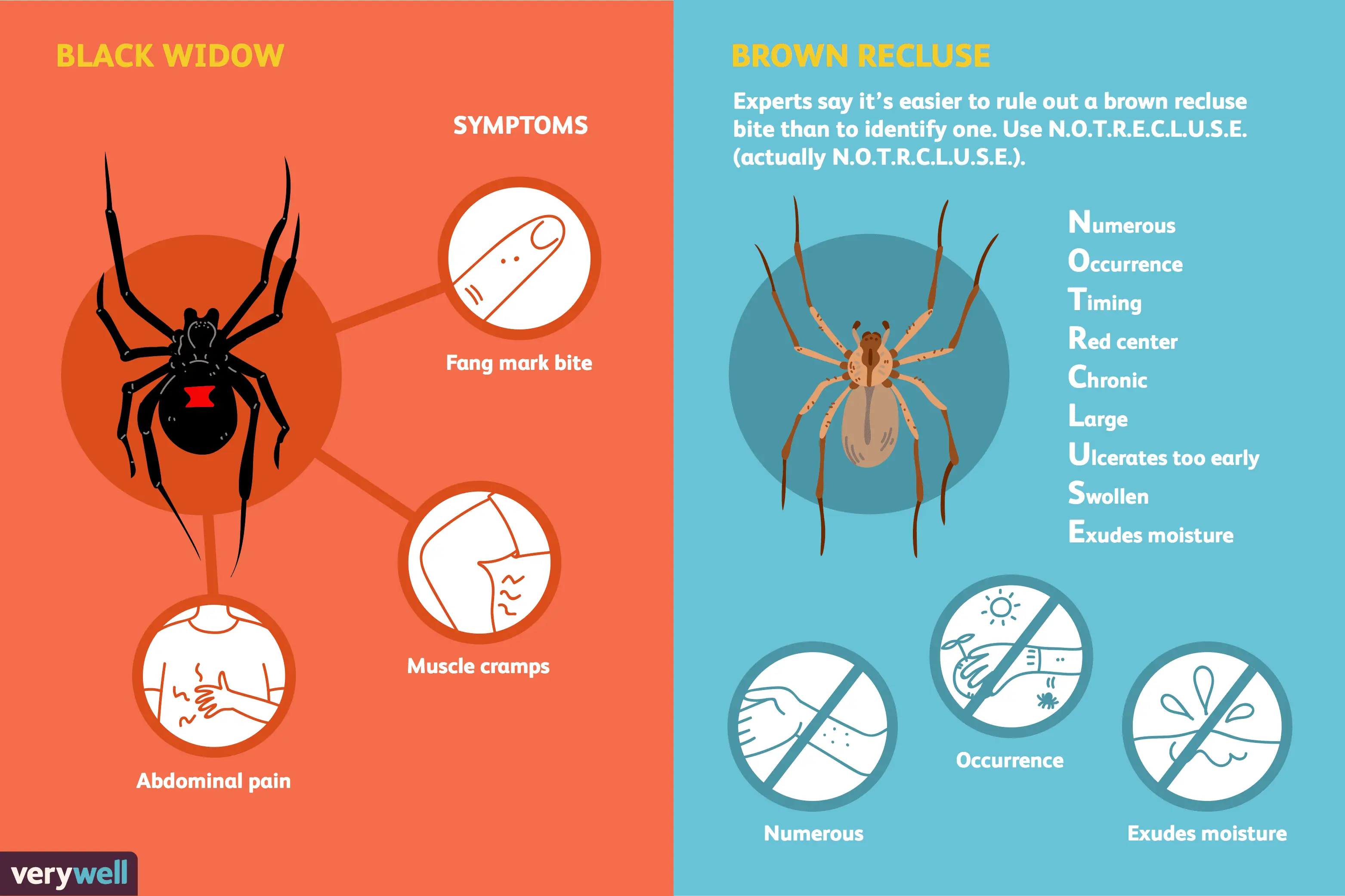 Spider bite &#8211; characteristic symptoms, types of spiders