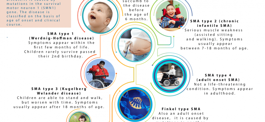 Spinal Muscular Atrophy (SMA) &#8211; diagnosis, clinical forms