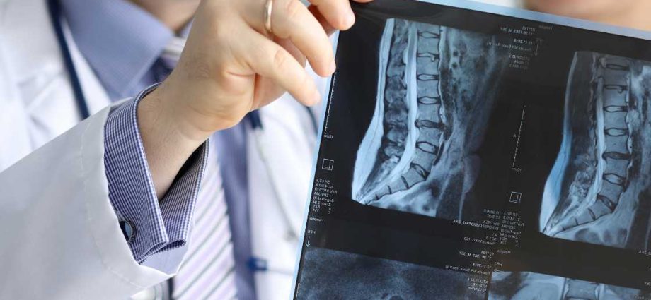 Spine doctor &#8211; orthopedist or neurologist?