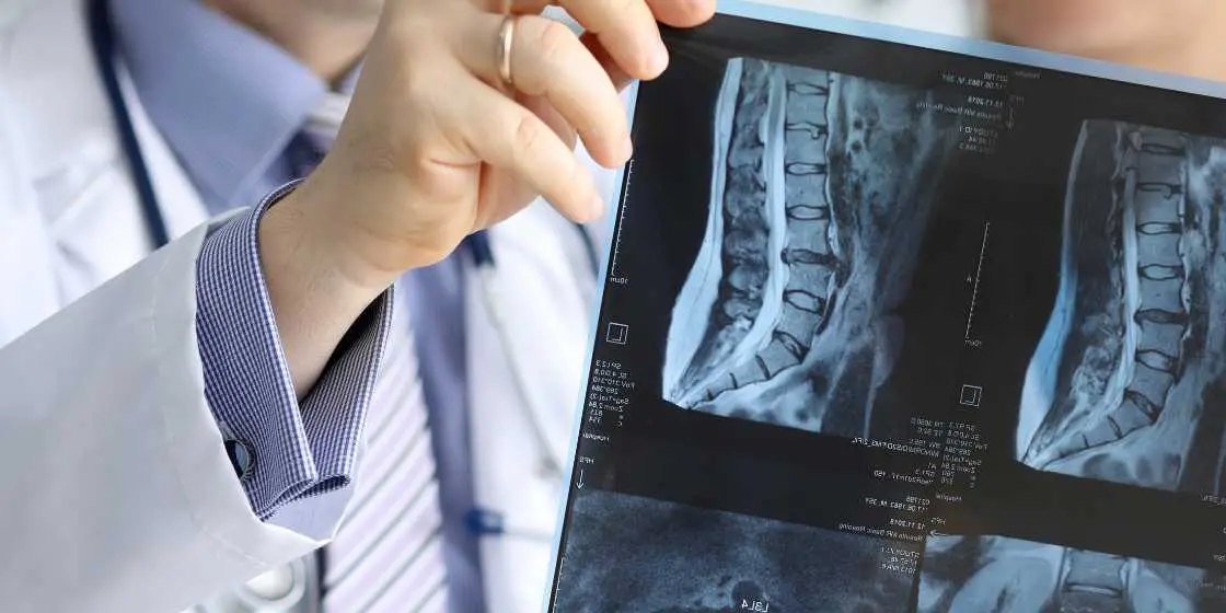 Spine doctor &#8211; orthopedist or neurologist?