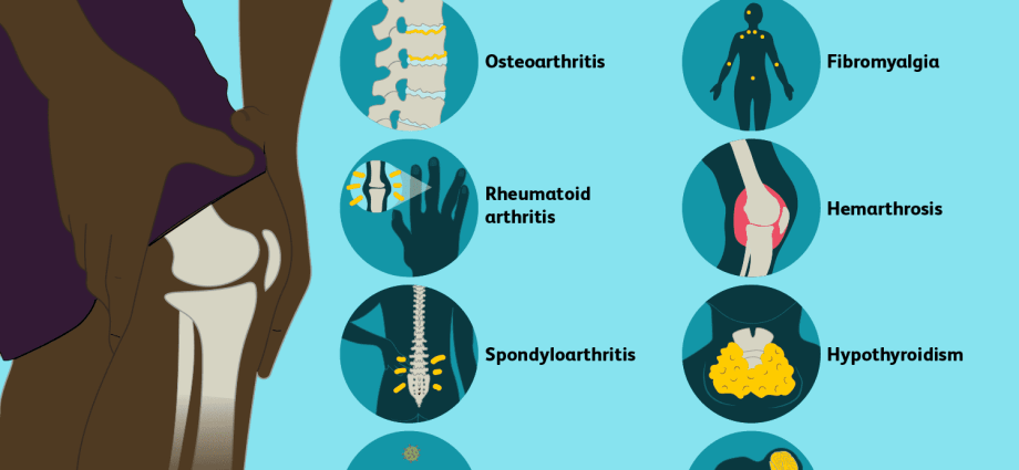 Spine, knees, hips &#8211; why do joints hurt? Common causes