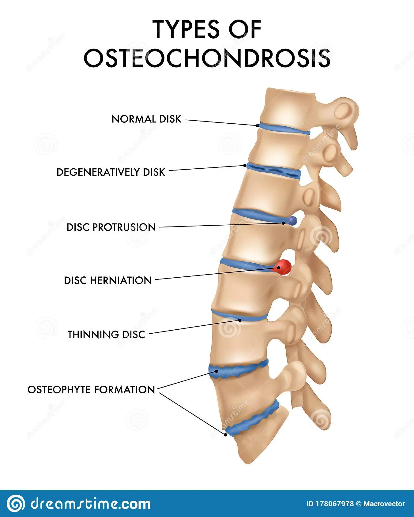 Spine &#8211; structure, diseases