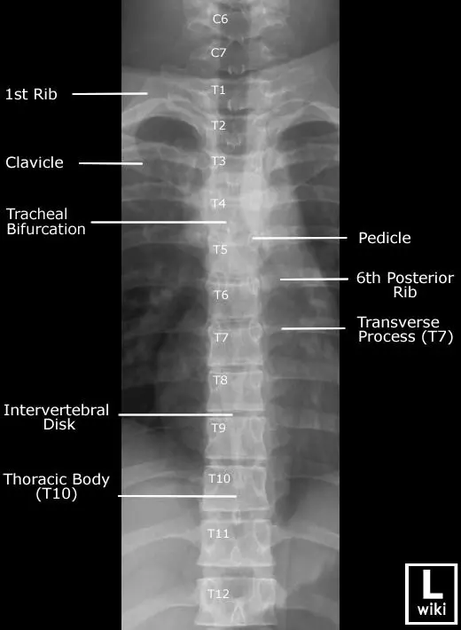 Spine X-ray &#8211; how to interpret the result?