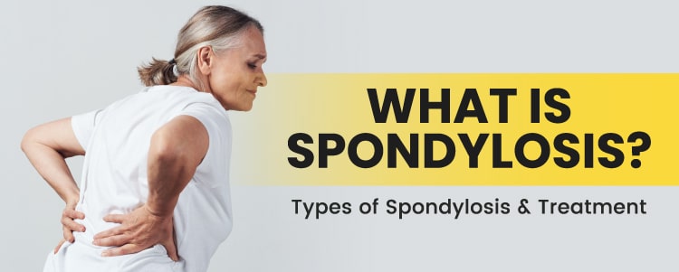 Spondylosis &#8211; types and diagnosis. Treatment of spine degeneration