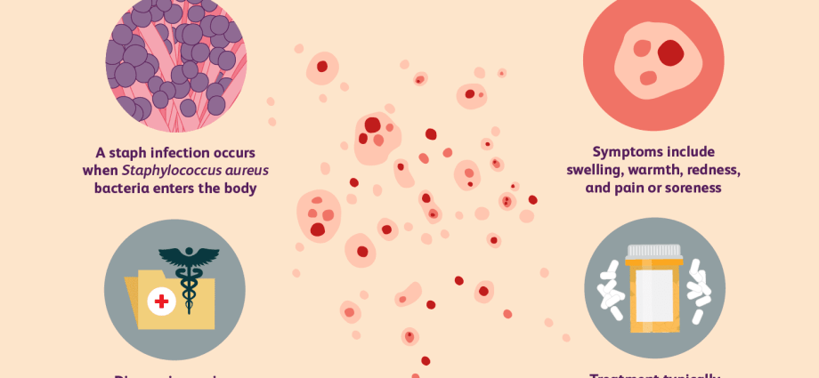 Staphylococcus aureus &#8211; signs of infection. What is the treatment like?