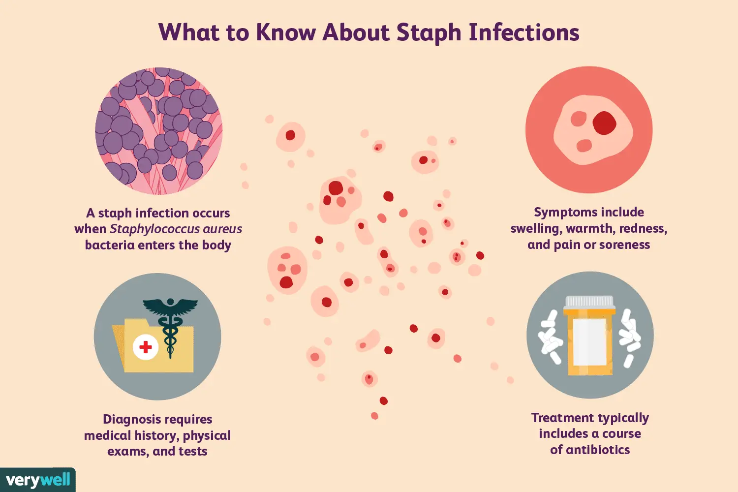 Staphylococcus aureus &#8211; signs of infection. What is the treatment like?