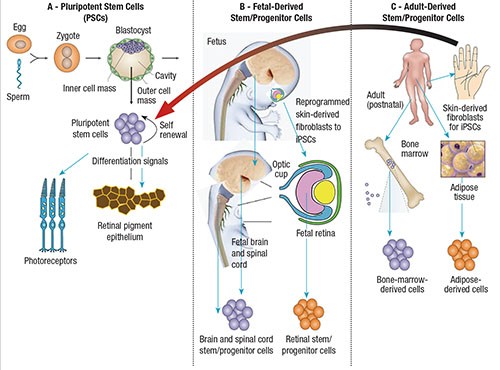 Stem cells &#8211; a breakthrough in ophthalmology