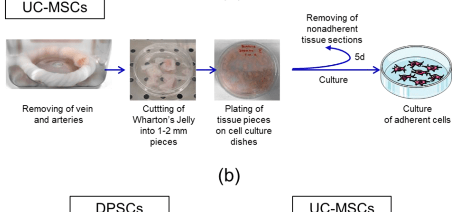 Stem cells will repair joints. A landmark operation in Gdańsk