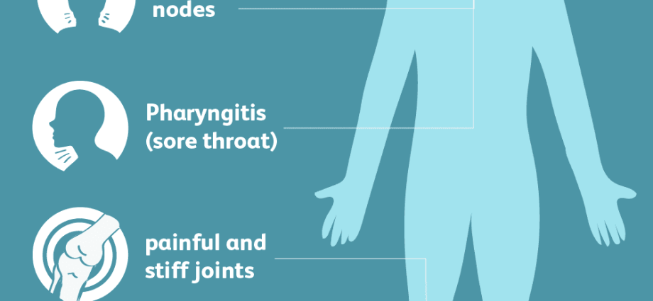 Still&#8217;s disease &#8211; what exactly does it mean and who is at risk of it?