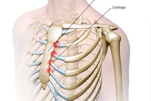 Stinging behind the breastbone