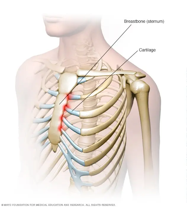 Stinging behind the breastbone