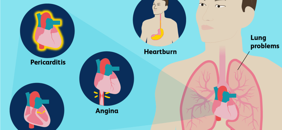 Stings in the chest &#8211; causes, types, diagnosis. When to see a doctor?