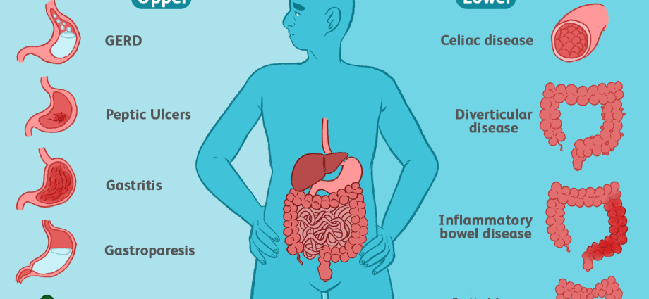 Stomach &#8211; structure, most common diseases, treatment