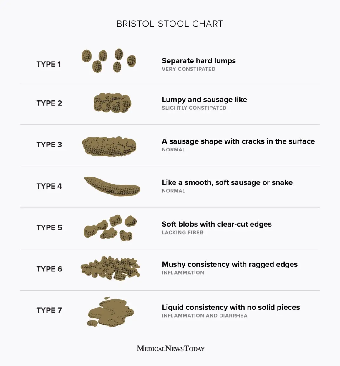 Stool &#8211; appearance and characteristics. What does a change in the color of my stool show?