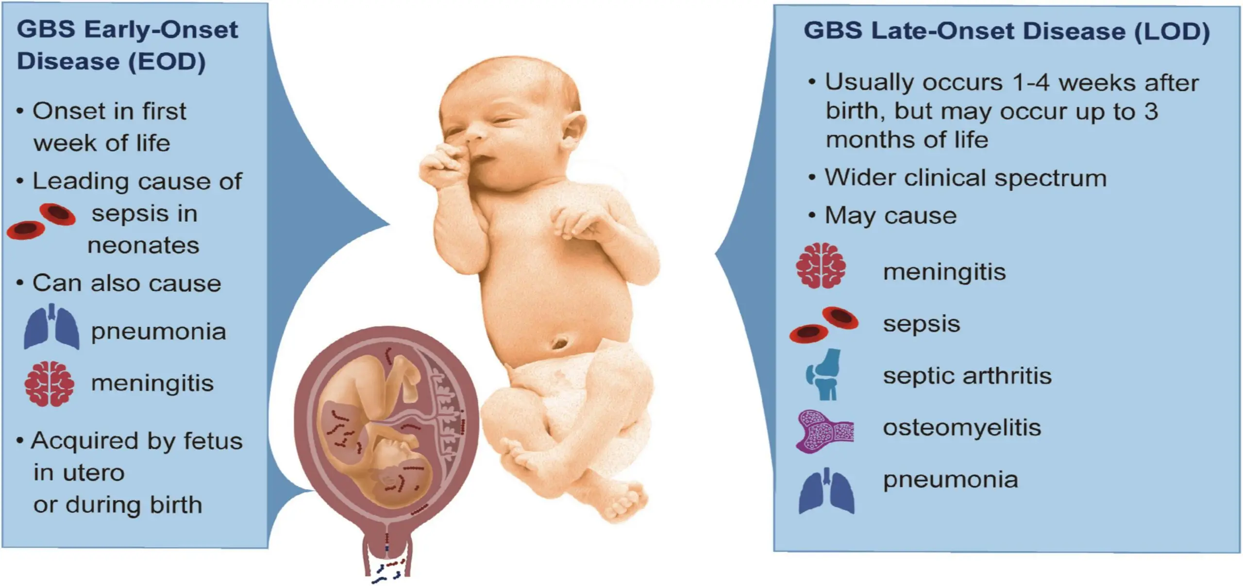 Streptococcus agalactiae &#8211; group B streptococcus (GBS) &#8211; a threat to the newborn