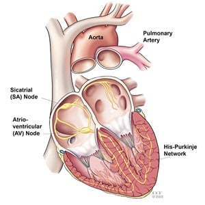 Sudden cardiac death