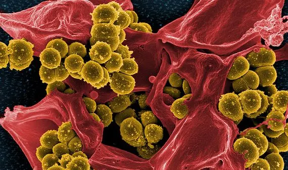 Superbugs are attacking. A quiet XNUMXst century pandemic that kills millions