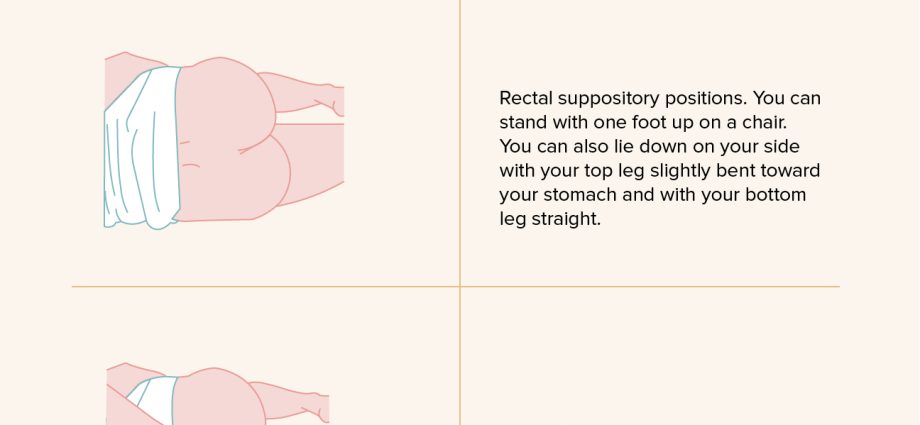 Suppositories for hemorrhoids &#8211; action, indications, contraindications, price. How to apply suppositories for hemorrhoids?