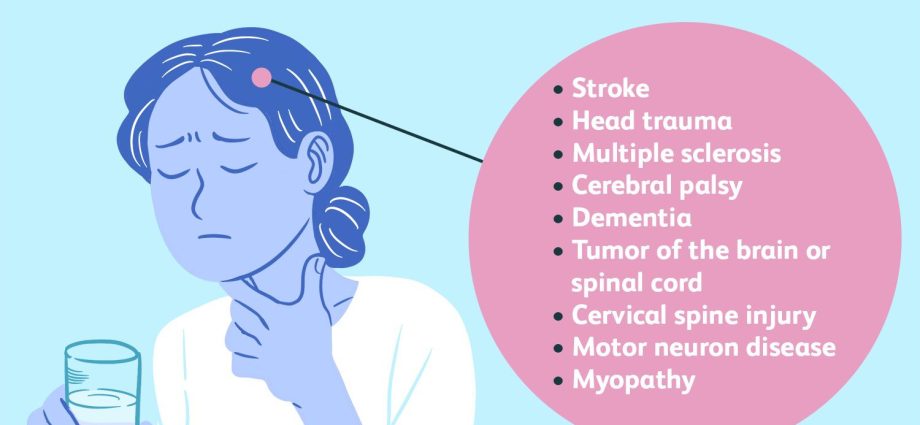 Swallowing disorders