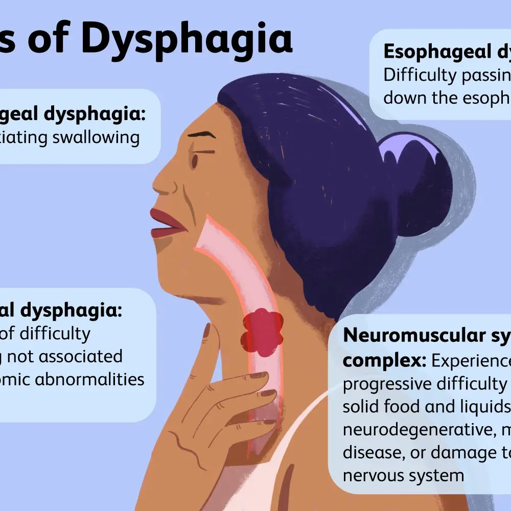 Swallowing problems &#8211; how to feed a sick person? Risk of choking and difficulty swallowing