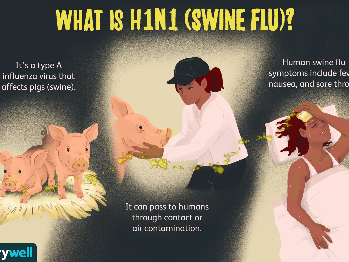 Swine flu A / H1N1 &#8211; symptoms, infection, treatment. Vaccine for AH1N1