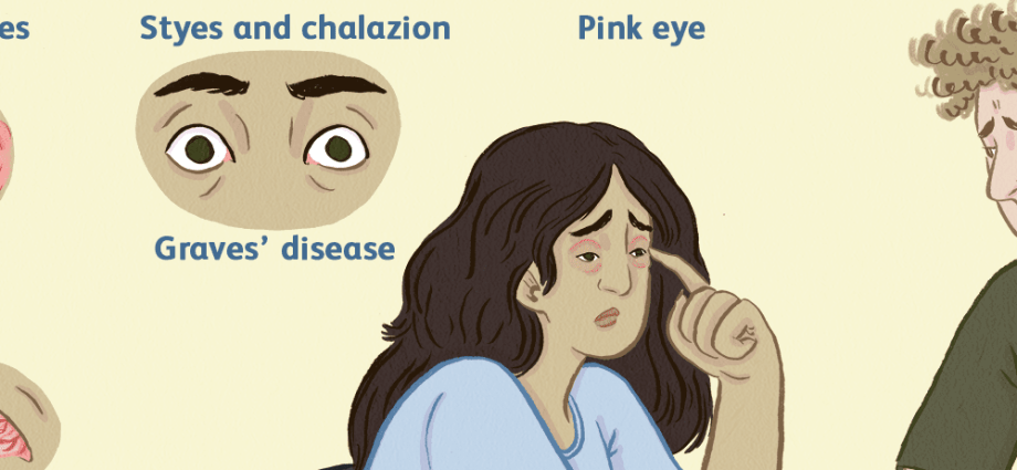 Swollen eyes &#8211; the most common causes. What helps with puffy eyes?