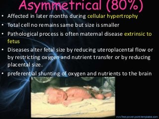 Symmetric and asymmetric fetal hypotrophy. What is the treatment of fetal hypotrophy?