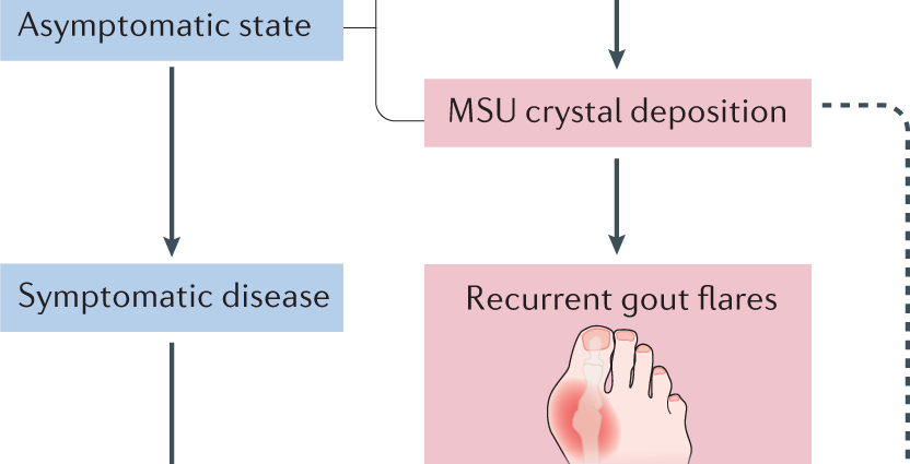 Symptoms of chronic kidney disease begin when it is too late. Simple research is enough